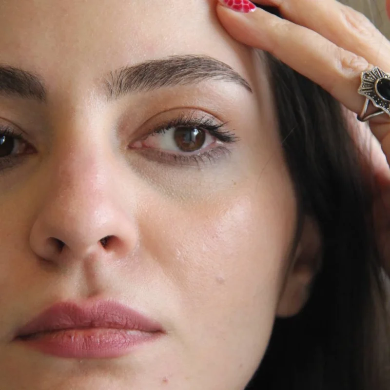 اصلاح صورت - Image 3